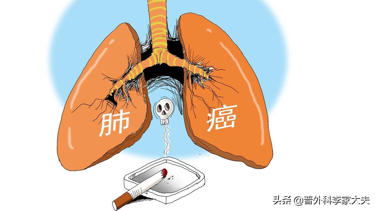 肺腺癌出现声音嘶哑能治好吗?