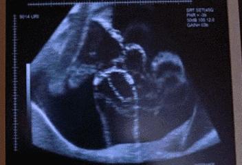 你们是如何发现自己怀孕的,你是怎么发现自己怀孕的是什么梗