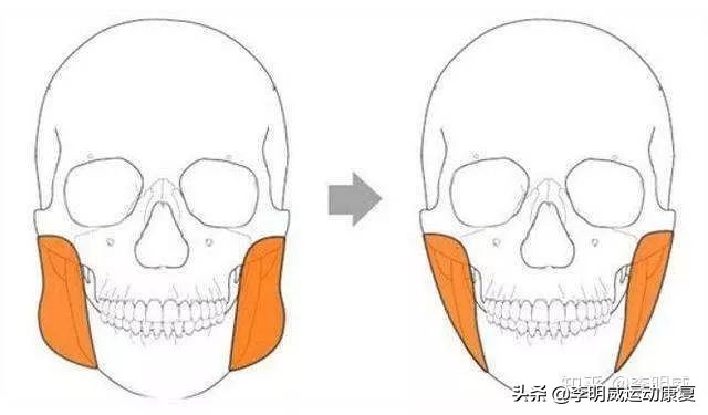 新生儿大小脸怎么矫正,教你如何矫正大小脸