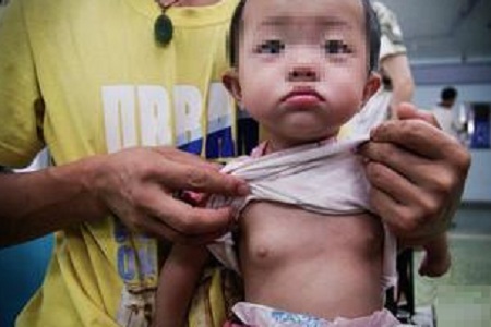 9岁多女孩来月经需要做什么检查,9岁女孩来月经需要做哪些检查