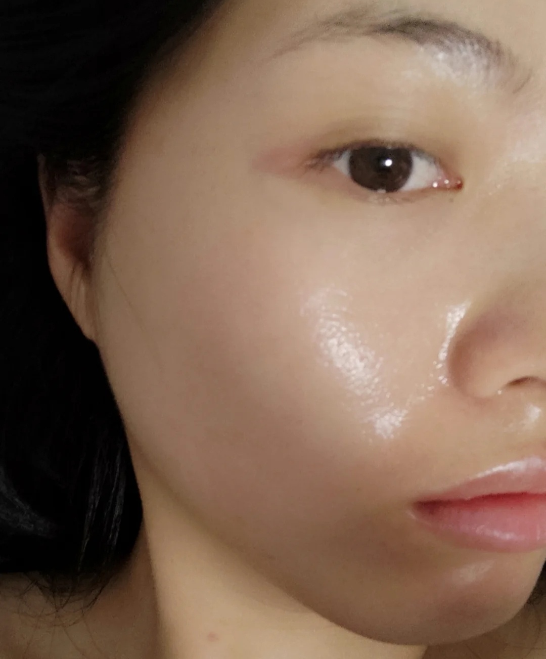 油性皮肤更抗衰老吗,油性皮肤保湿有用吗