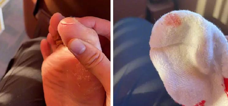 中国李宁撞高帮鞋,李宁鞋翻车