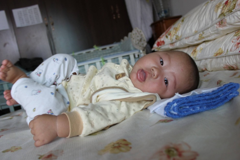 两岁孩子咳嗽厉害有痰久治不愈,12岁娃咳嗽一周成白肺