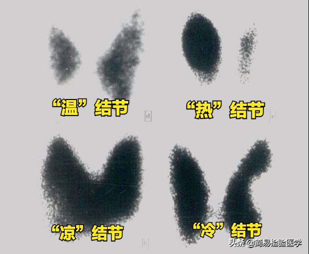 外科甲状腺疾病的思维导图,一秒看懂甲状腺报告单趣味讲解