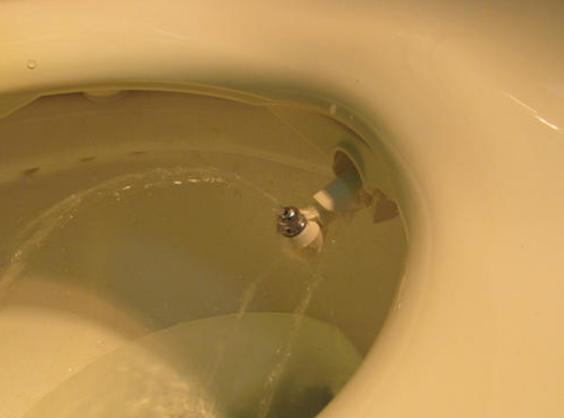 肛裂痔疮会引起肛门瘙痒,痔疮肛裂肉球消除的小妙招