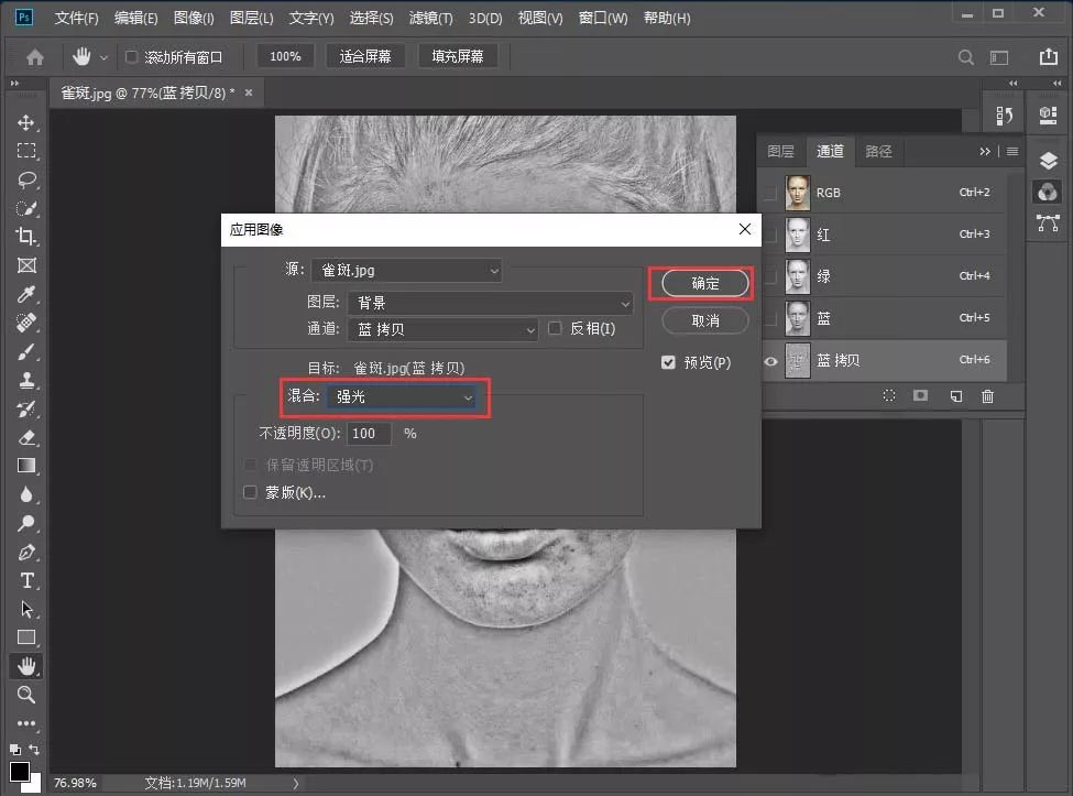 祛除脸部雀斑最有效的方法,有什么日常方法可以去除脸上雀斑