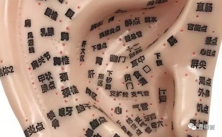 生活小诀窍——耳压治疗落枕