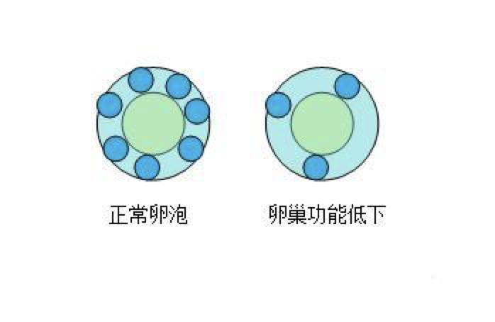 卵巢功能减退怎么备孕,失眠与卵巢功能减退关系