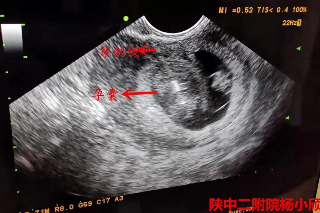 陕西中医药大学附属医院生殖科,中医药大学附属第二医院生殖中心