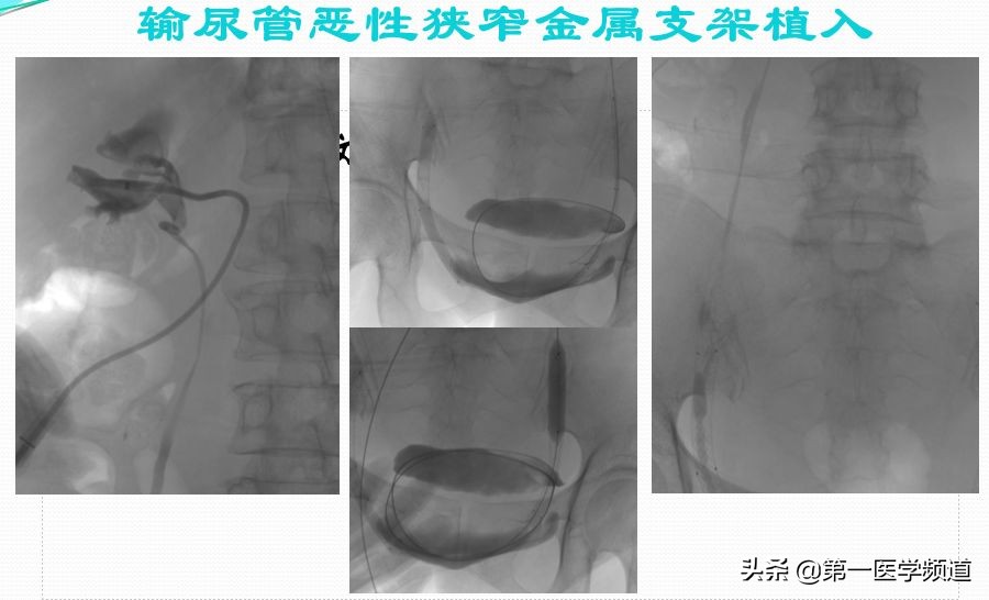 「医影传声」上海交通大学医学院附属瑞金医院卢湾分院放射科主任