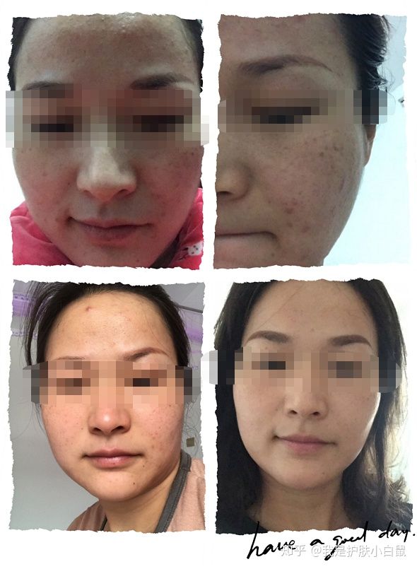 烟酰胺浓度不是越高越好，你知道么？