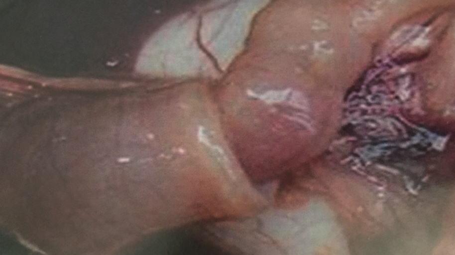 黑斑青蛙养殖技术视频教程,青蛙黑斑蛙高密度养殖技术培训