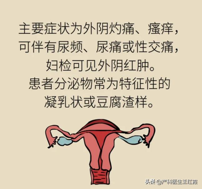 白带增多、脓性灰黄色伴豆渣样、霉菌性阴道炎真的是“发霉”了吗