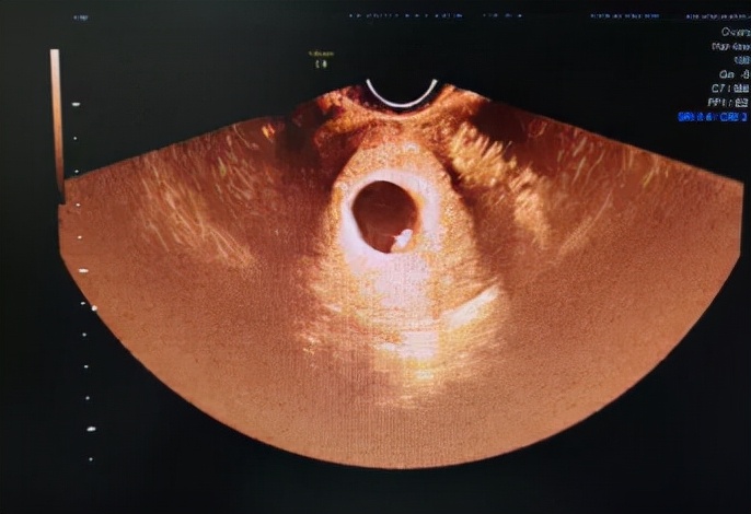 孕期超声检查须知,准妈妈必读产前超声小课堂