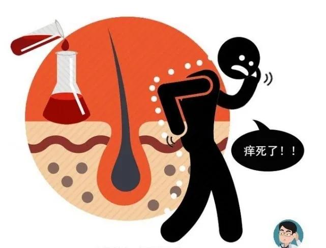 身上哪三处痒可能是癌症,身上起红疙瘩是癌症前期表现