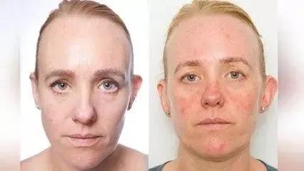 你真的会护肤吗,卸妆不对护肤白费最全卸妆指南