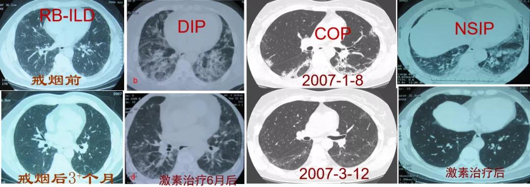 代华平视频,中日友好医院代华平