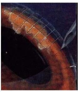 猫眼睛溃疡最佳治疗方法,猫眼睛溃疡用什么眼药水