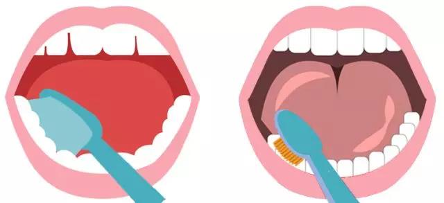 冬季牙龈上火出血很严重,牙龈出血易上火吃什么药
