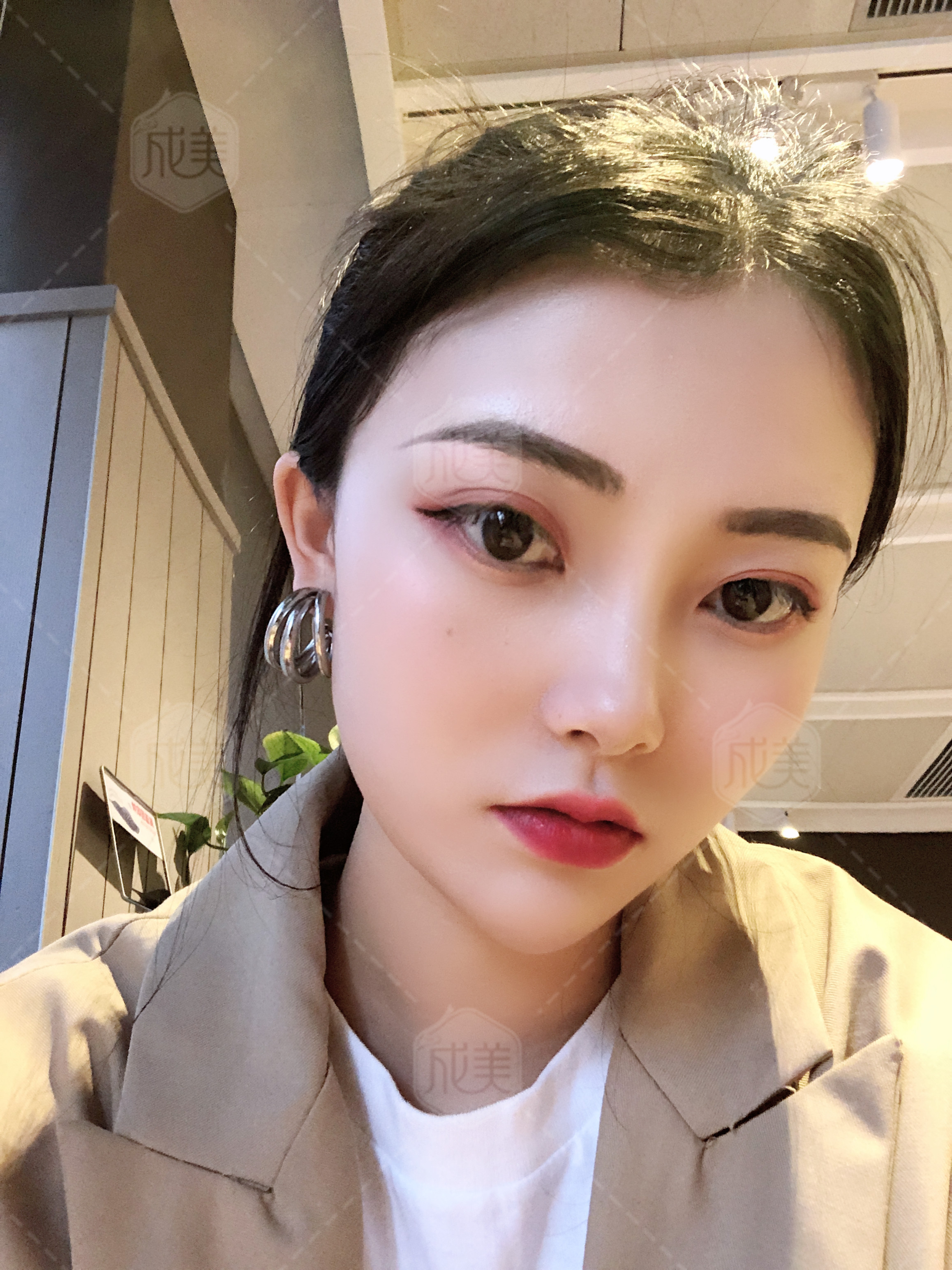 硅胶隆鼻没效果修复遭罪吗,硅胶假体隆鼻不满意最佳取出时间