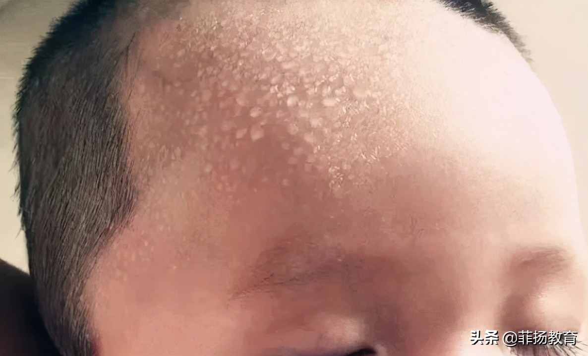 一觉醒来身上全是汗,一觉醒来浑身全是汗