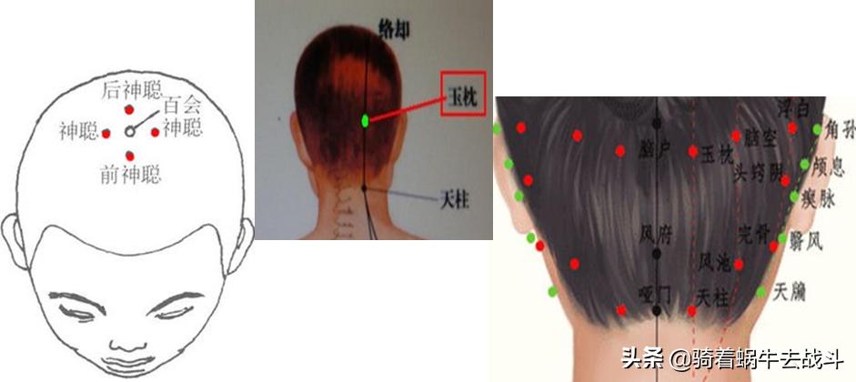 小朋友们如何治疗假性近视,小朋友假性近视怎么治疗