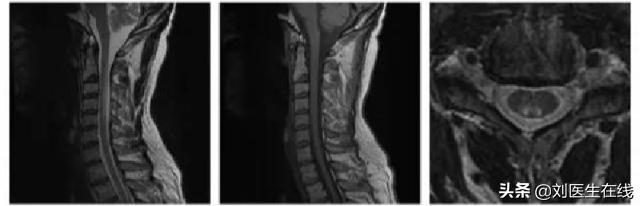 老人腿无力行走需要检查什么,老人如何补叶酸和维生素b12