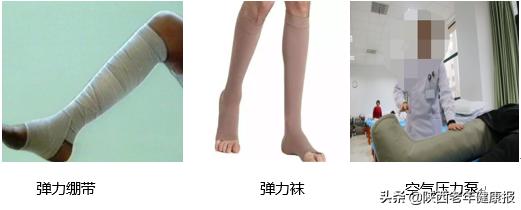 下肢静脉性溃疡伤口护理,关于下肢静脉性溃疡伤口图片