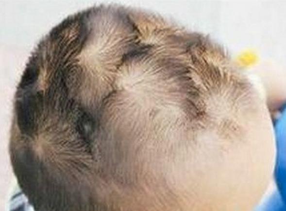 孩子头顶有两个旋性格,男孩头顶两个旋迷信说法