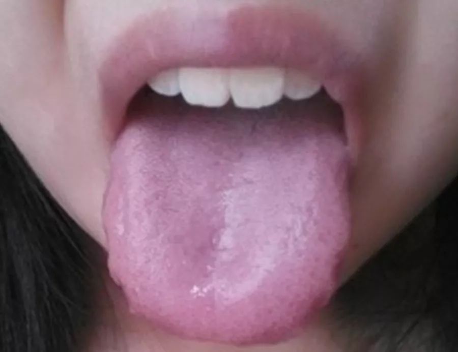 脾胃不好十种中成药,脾胃常见不舒服的症状