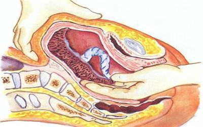 生完孩子产道会松弛吗,生完孩子产道几指正常