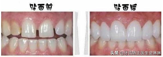 诺尔口腔牙齿矫正怎么样,淄博诺尔漫口腔