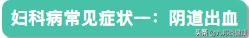 妇科疾病常见症状及鉴别要点,妇科疾病自检