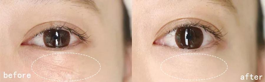 眼霜到底有没有用啊,眼霜里面有什么成分不能用