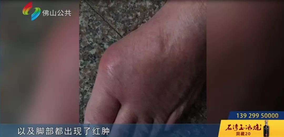 佛山八旬老人在B超室摔出“大包”！女儿大怒：“三个医生在场竟无人扶！”