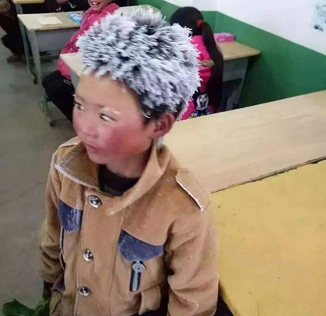 满头冰花的男孩现状,满头冰花的男孩