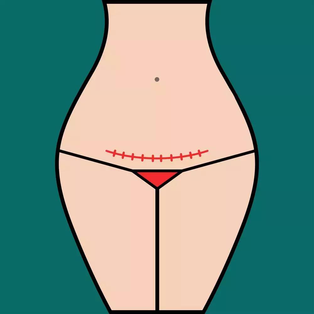 产后42天恶露没干净能去复查了吗,产后42天复查盆腔积液是什么意思