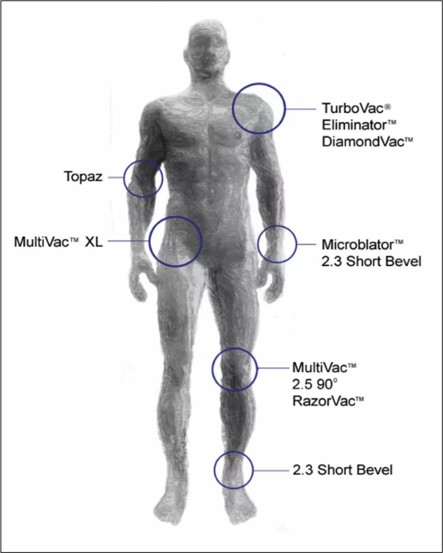 关节镜微创技术对关节炎有用吗,关节镜治疗过程