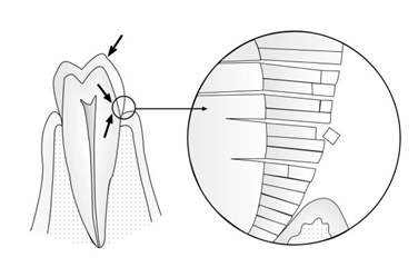 刷牙感觉牙齿松动怎么回事,由于刷牙太猛导致牙齿损伤怎么办