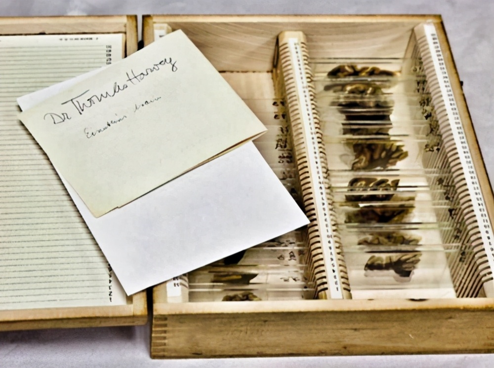 爱因斯坦被偷大脑全过程,爱因斯坦竟然被人偷走大脑的秘密