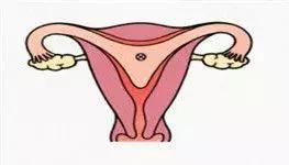 卵巢早衰，人易老！这5种表现都在告诉你：不保护就老了