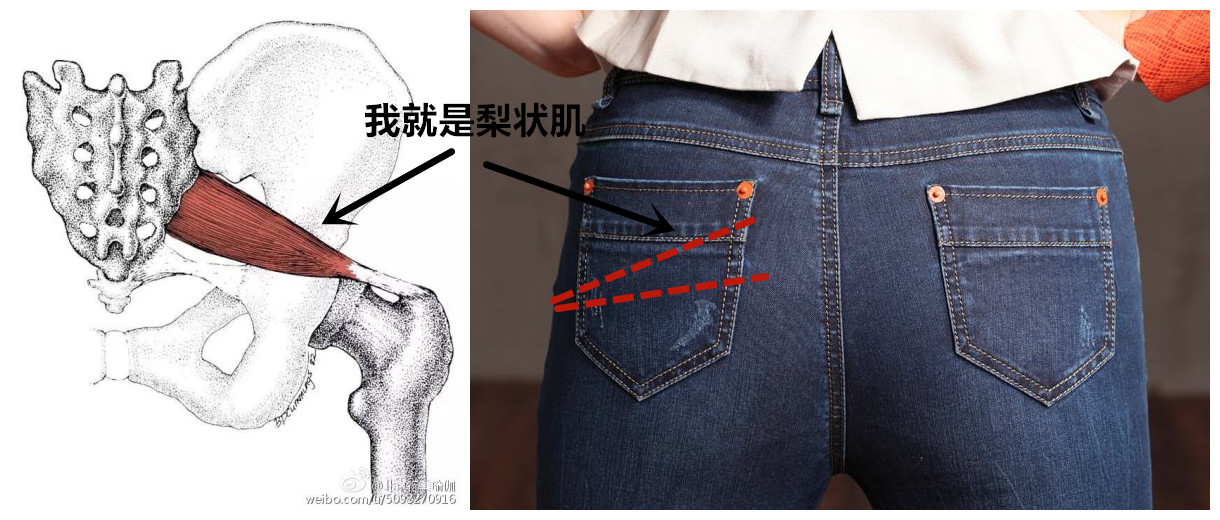 屁股痛、腿麻，有块肌肉受伤了