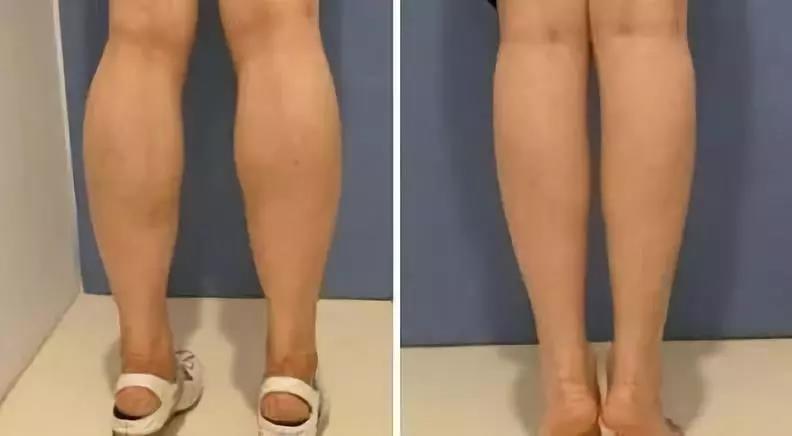 蔡依林谈瘦腿袜,蔡依林瘦腿袜照片