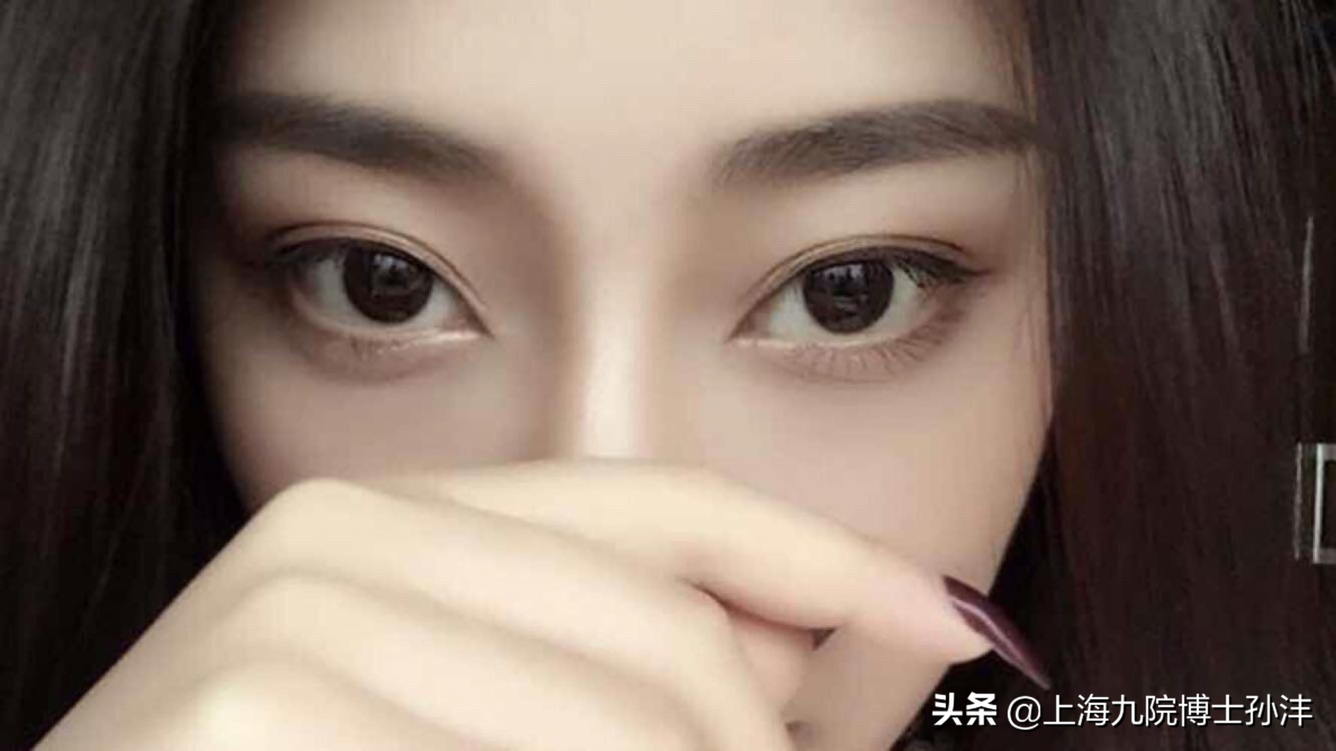 上海九院孙沣博士眼角修复,上海九院美容科孙沣