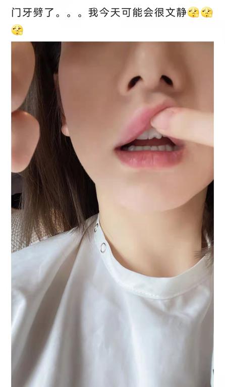 @瓜子*党**和*力暴**开瓶侠看过来！戚薇同款牙，你不pick一下吗