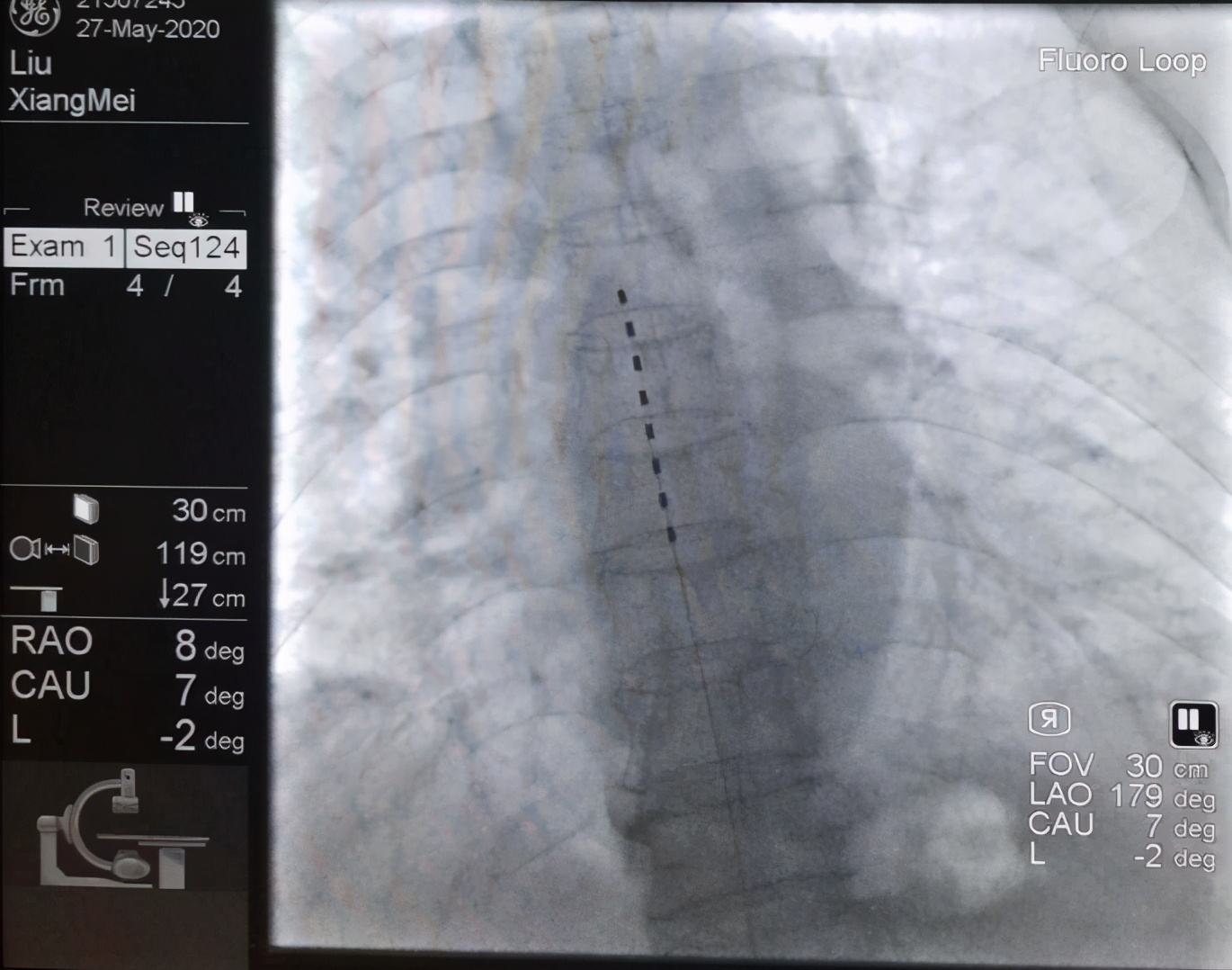 赶走疼痛，一身轻松！腰背痛，太原市中心医院疼痛科有妙招