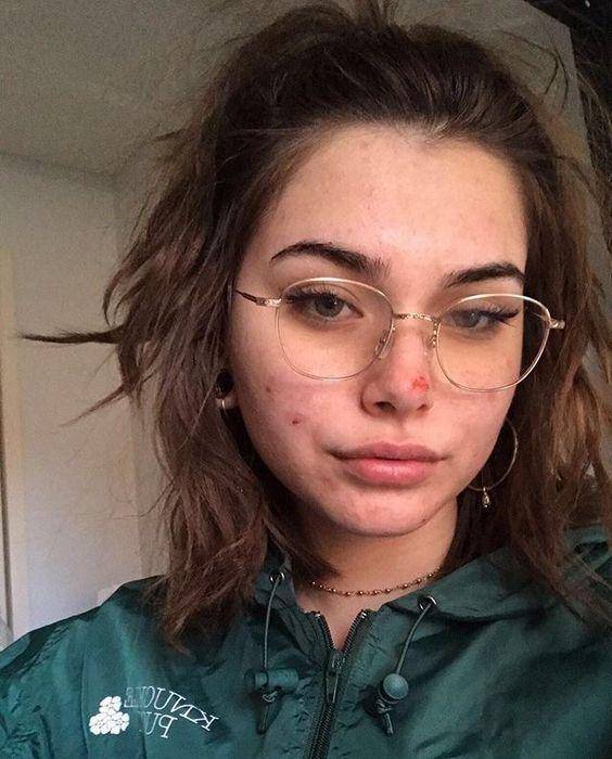 濂崇敓鐖嗙棙蹇呬拱娓呭崟鑽啅,鐖嗙棙浜у搧蹇呬拱娓呭崟