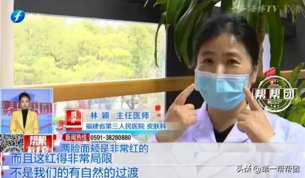 用了面膜皮肤变黑又脱皮,网红面膜变成激素皮炎