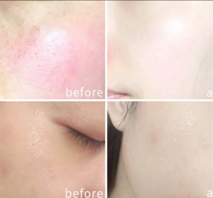 韩国面膜小鲸鱼,小鲸鱼面膜和黄金面膜哪个好用