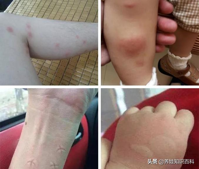 掌握这些驱蚊妙招，安全有效地呵护宝宝，让宝宝安然一夏